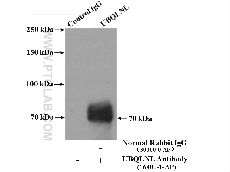 IP experiment of Jurkat using 16400-1-AP