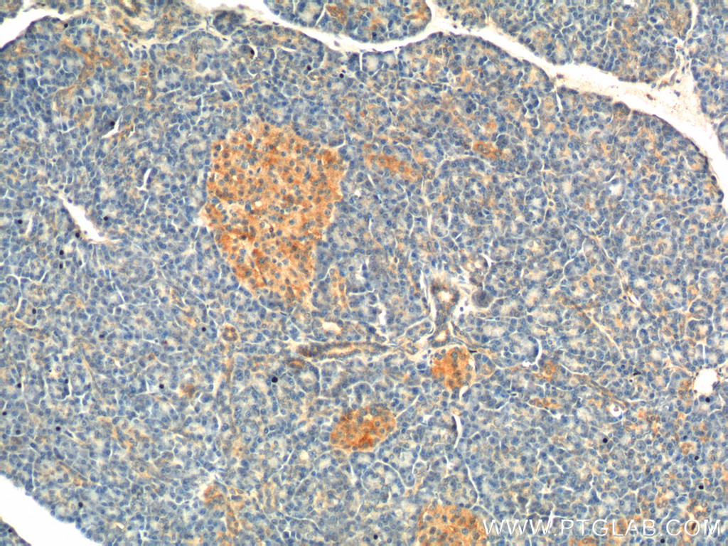 IHC staining of human pancreas using 26069-1-AP