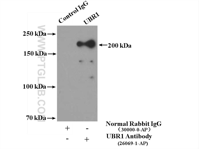 IP experiment of mouse skeletal muscle using 26069-1-AP