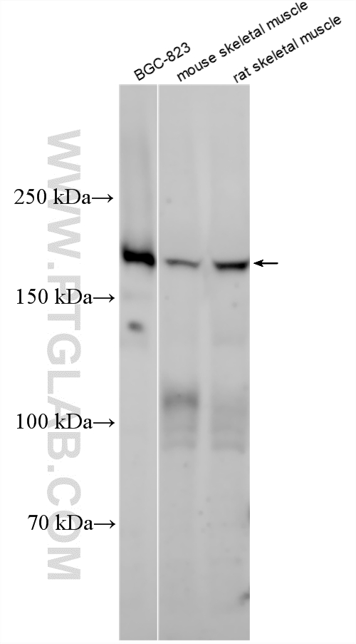 Various lysates were subjected to SDS PAGE followed by western blot with 26069-1-AP (UBR1 antibody) at dilution of 1:300 incubated at room temperature for 1.5 hours. WB analysis using 26069-1-AP