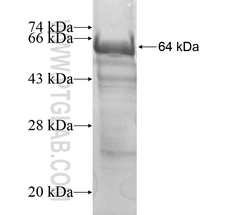 UBR1 fusion protein Ag13589 SDS-PAGE UBR1 fusion protein Ag13589 SDS-PAGE