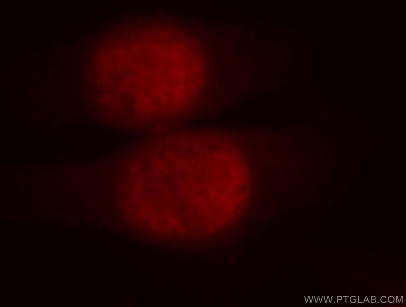 IF Staining of HepG2 using 18853-1-AP