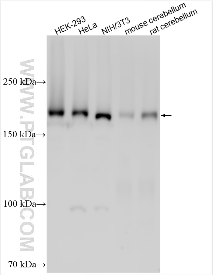 WB analysis using 18853-1-AP (same clone as 18853-1-PBS) WB analysis using 18853-1-AP (same clone as 18853-1-PBS)