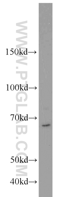 WB analysis of BxPC-3 using 18853-1-AP