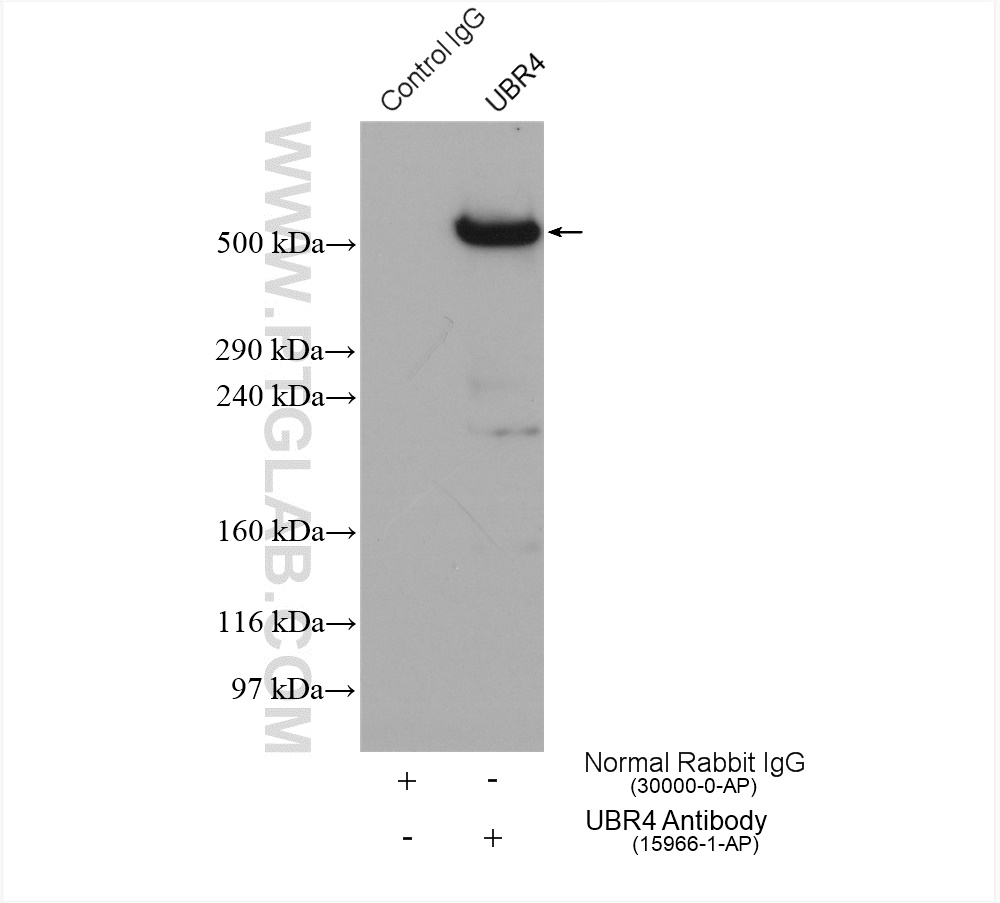 IP experiment of HeLa using 15966-1-AP (same clone as 15966-1-PBS)