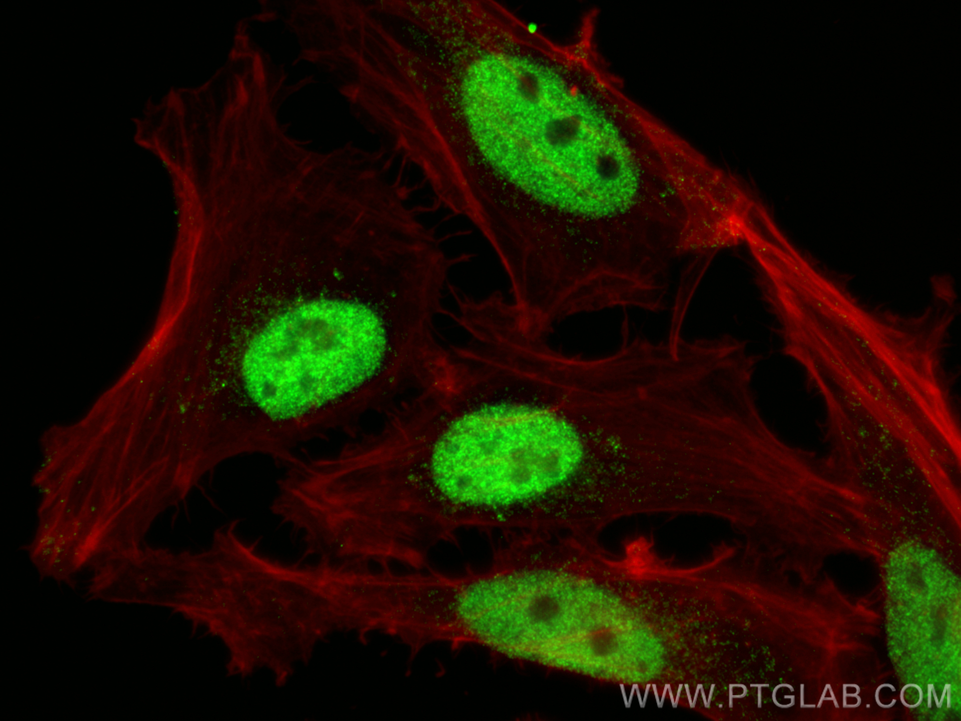 IF Staining of HeLa using 16903-1-AP
