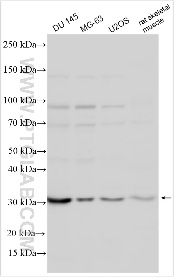 WB analysis using 20158-1-AP WB analysis using 20158-1-AP