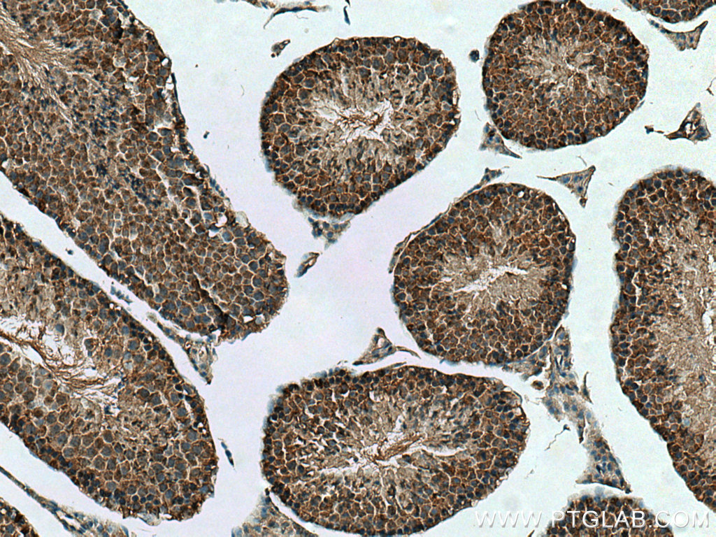 IHC staining of mouse testis using 16135-1-AP