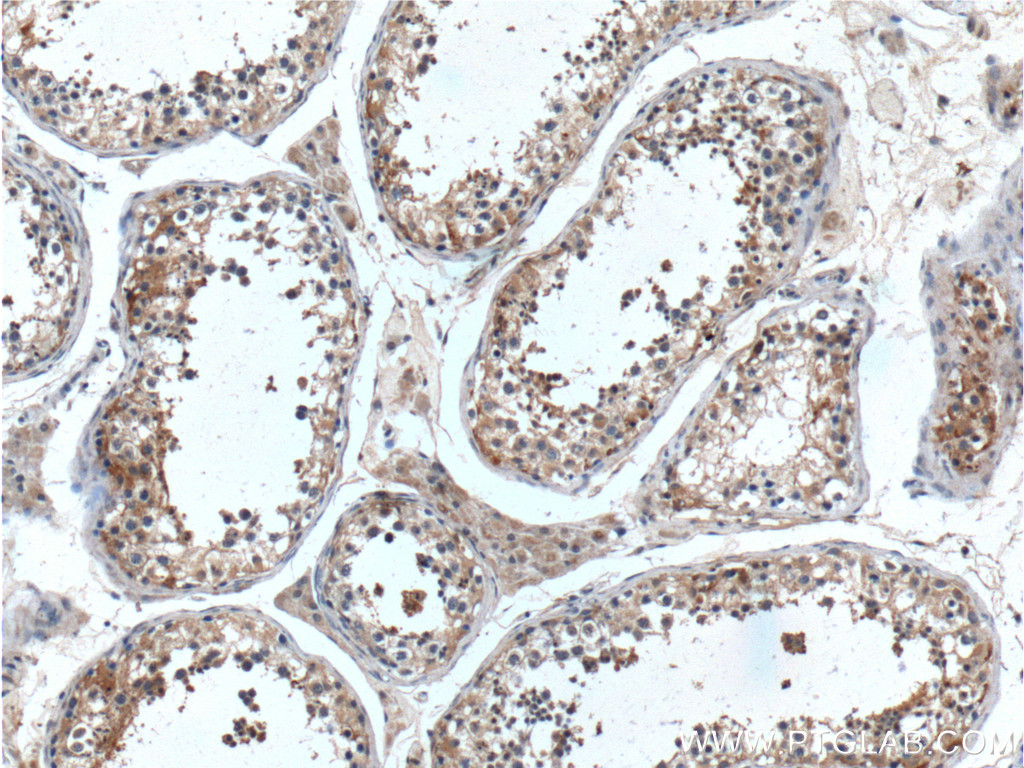 IHC staining of human testis using 13109-1-AP