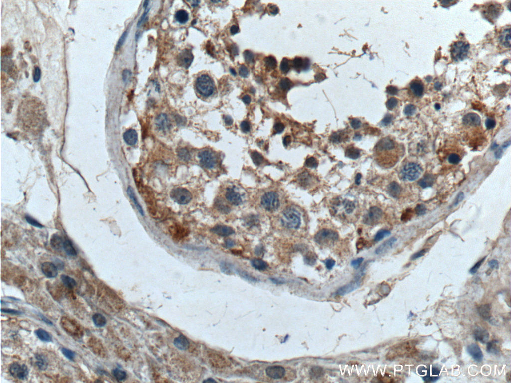 IHC staining of human testis using 13109-1-AP