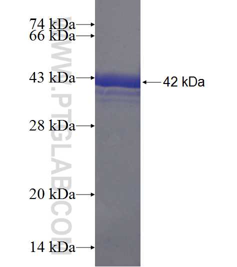 UBXN11 fusion protein Ag20398 SDS-PAGE UBXN11 fusion protein Ag20398 SDS-PAGE