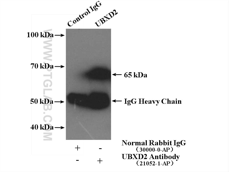 IP experiment of mouse brain using 21052-1-AP