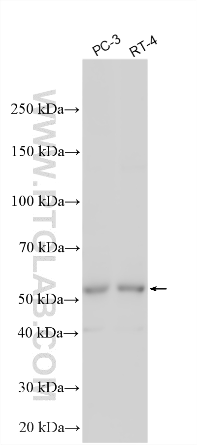 WB analysis using 14706-1-AP