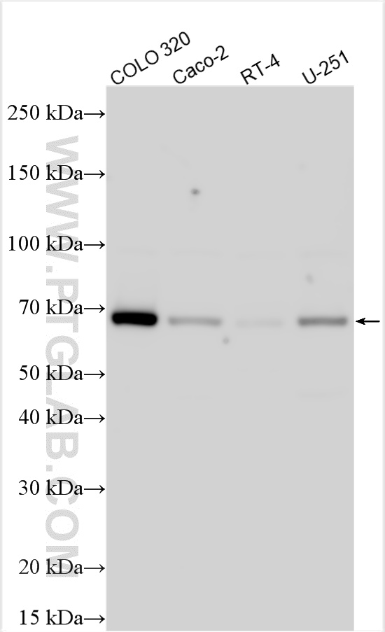 Various lysates were subjected to SDS PAGE followed by western blot with 32722-1-AP (UBXN7 antibody) at dilution of 1:4000 incubated at room temperature for 1.5 hours. WB analysis using 32722-1-AP