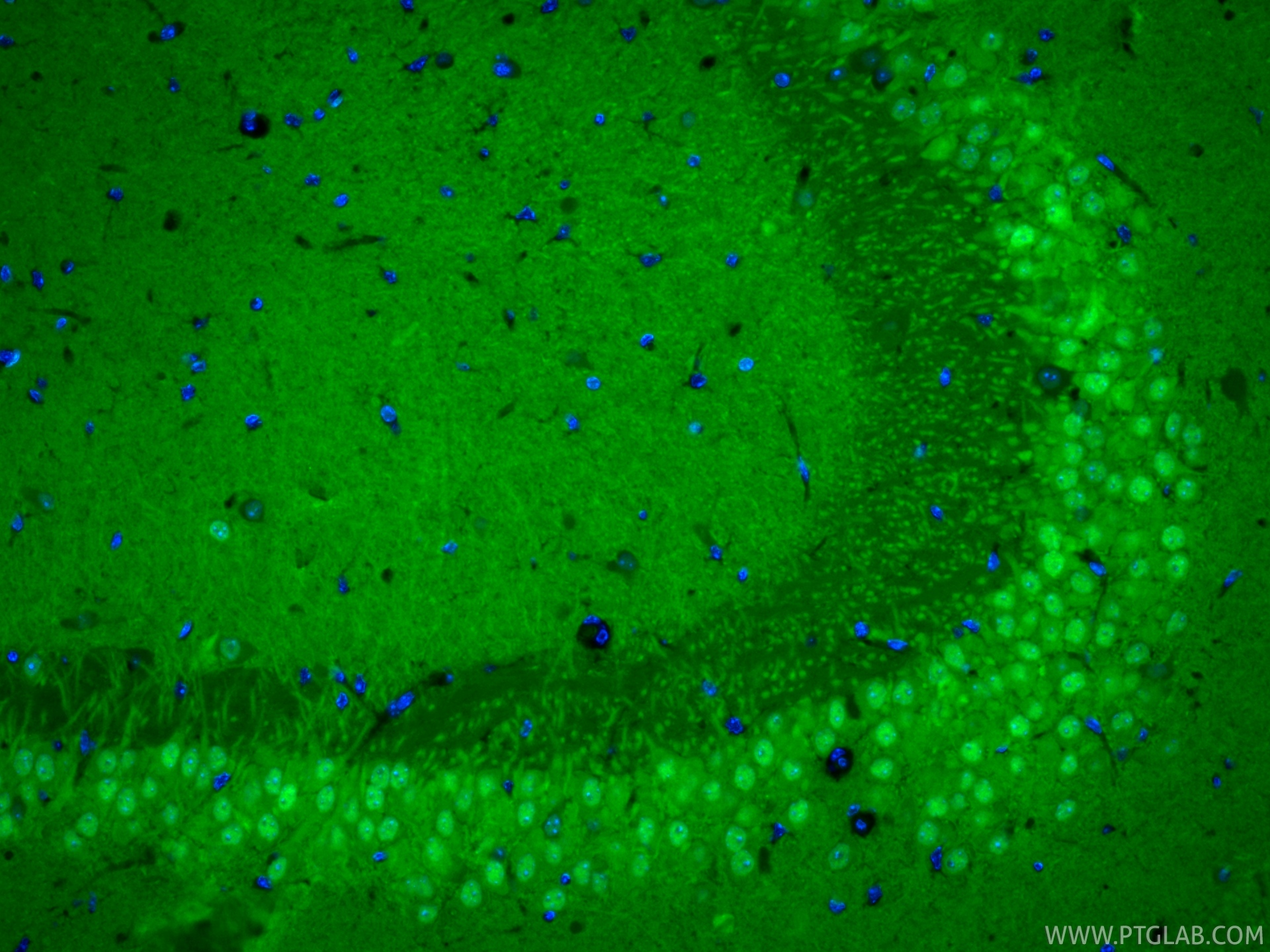 Immunofluorescent analysis of (4% PFA) fixed paraffin-embedded mouse brain tissue using CoraLite® Plus 488 UCH-L1/PGP9.5 antibody (CL488-84154-4, Clone: 241107B2 ) at dilution of 1:200. Heat mediated antigen retrieval with Tris-EDTA buffer (pH 9.0). IF Staining of mouse brain using CL488-84154-4