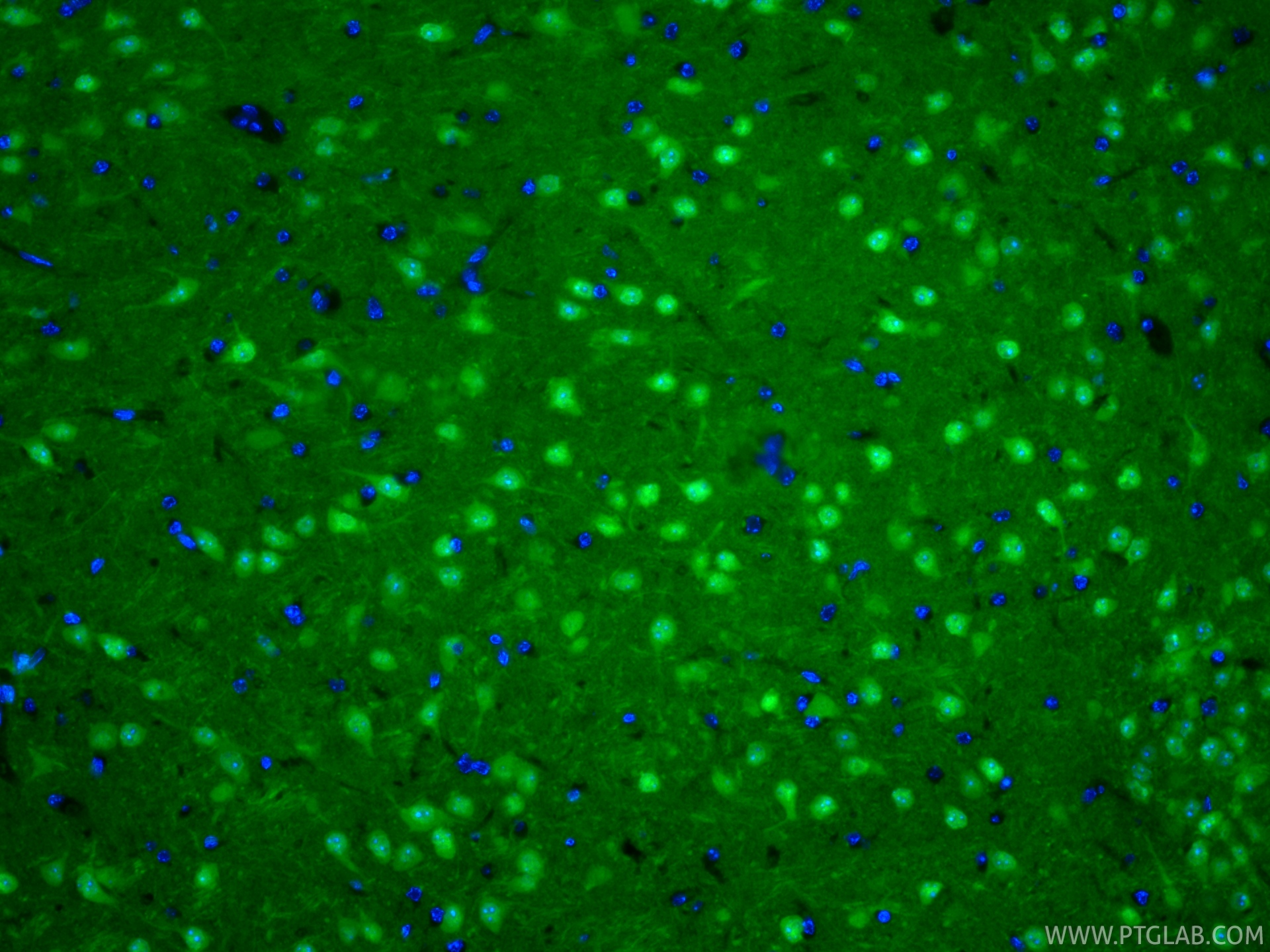 Immunofluorescent analysis of (4% PFA) fixed paraffin-embedded mouse brain tissue using CoraLite® Plus 488 UCH-L1/PGP9.5 antibody (CL488-84154-5, Clone: 241107B3 ) at dilution of 1:200. Heat mediated antigen retrieval with Tris-EDTA buffer (pH 9.0). IF Staining of mouse brain using CL488-84154-5