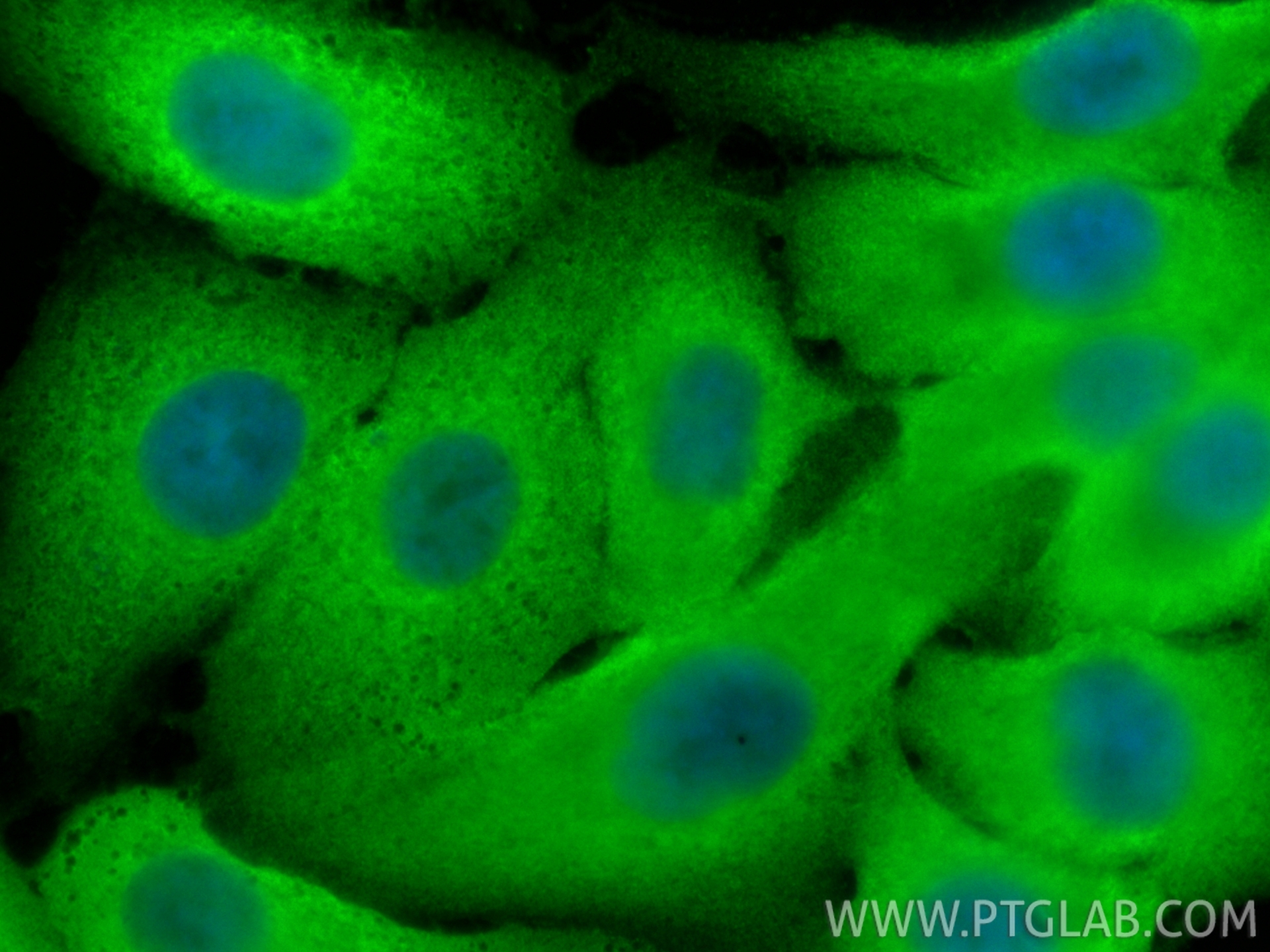 IF Staining of A549 using RMX00043