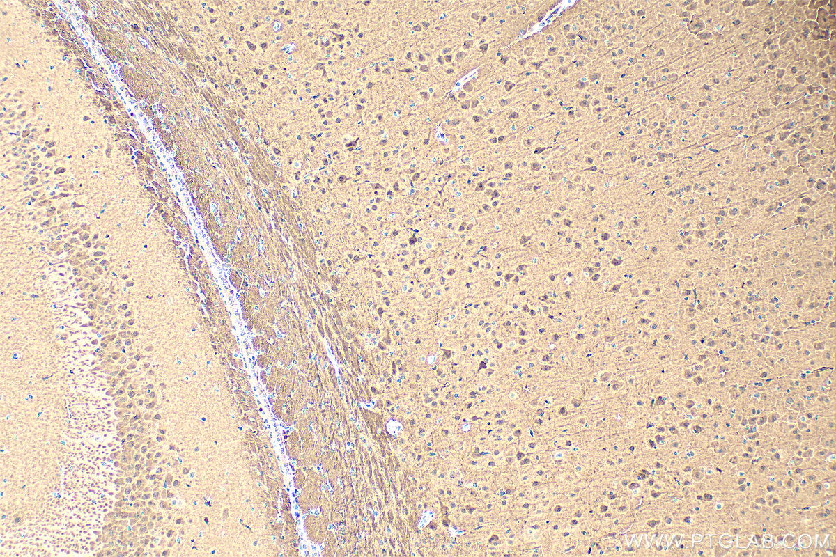 IHC staining of mouse brain using RMX00043