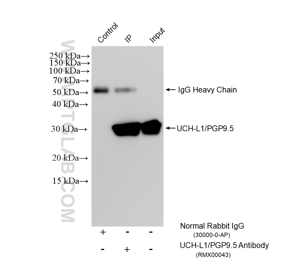 IP experiment of SH-SY5Y using RMX00043