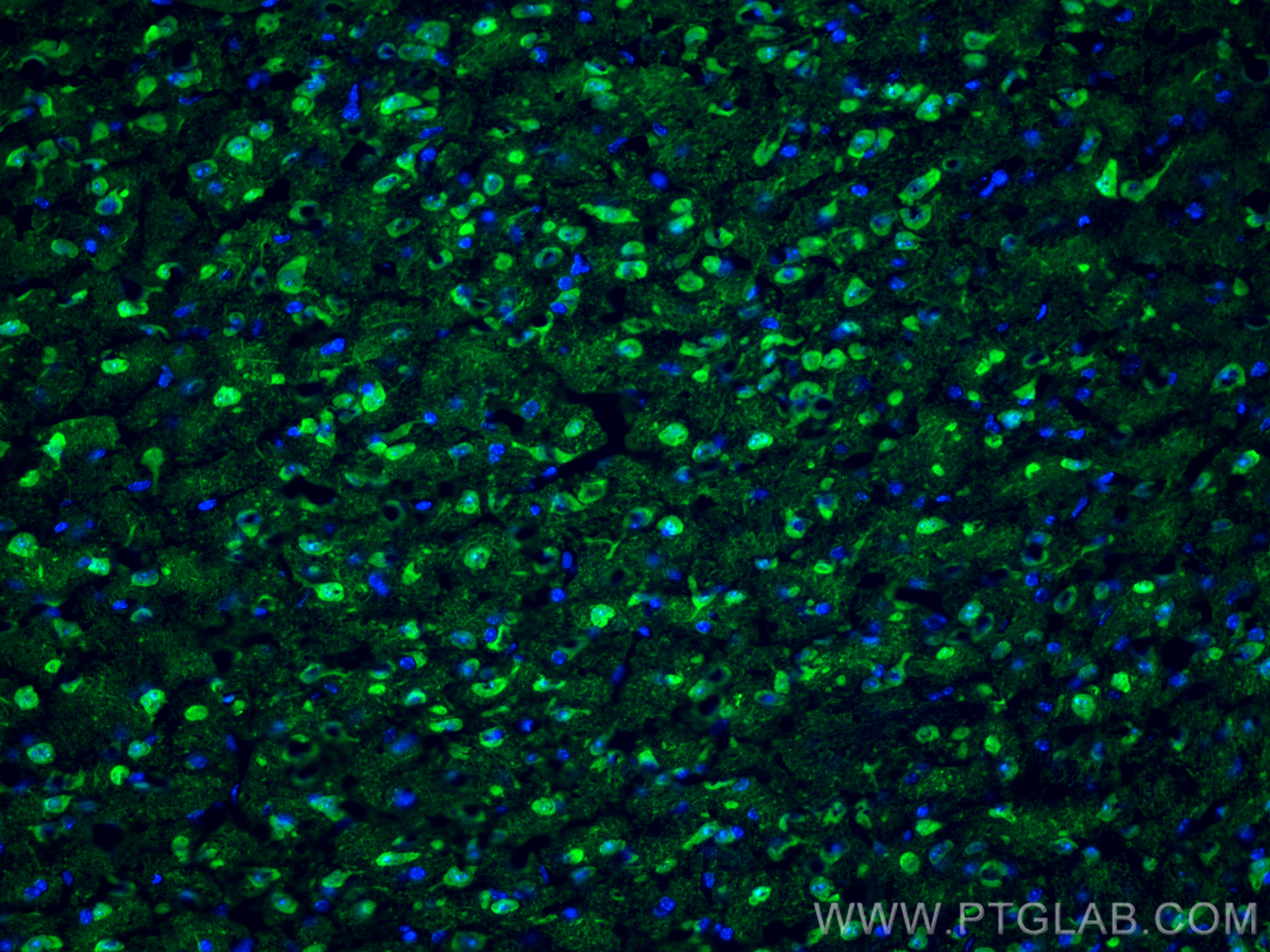 IF Staining of mouse brain using 14730-1-AP