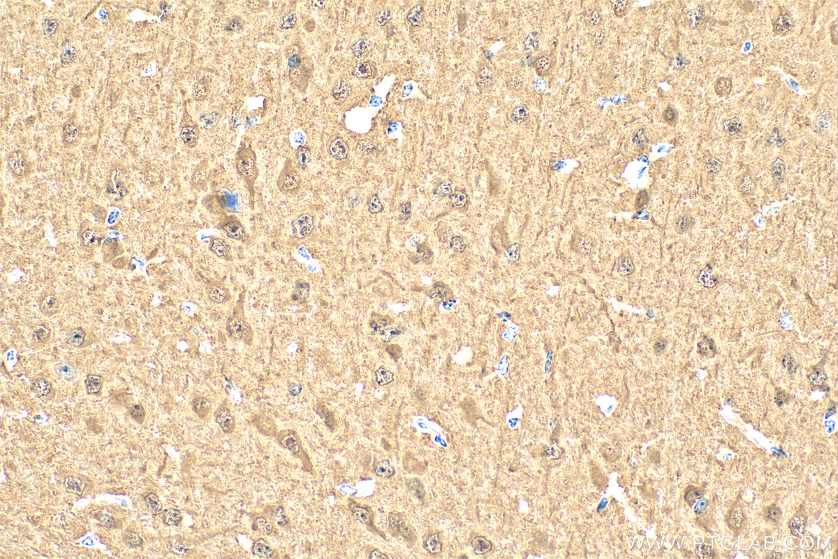 IHC staining of mouse brain using 14730-1-AP