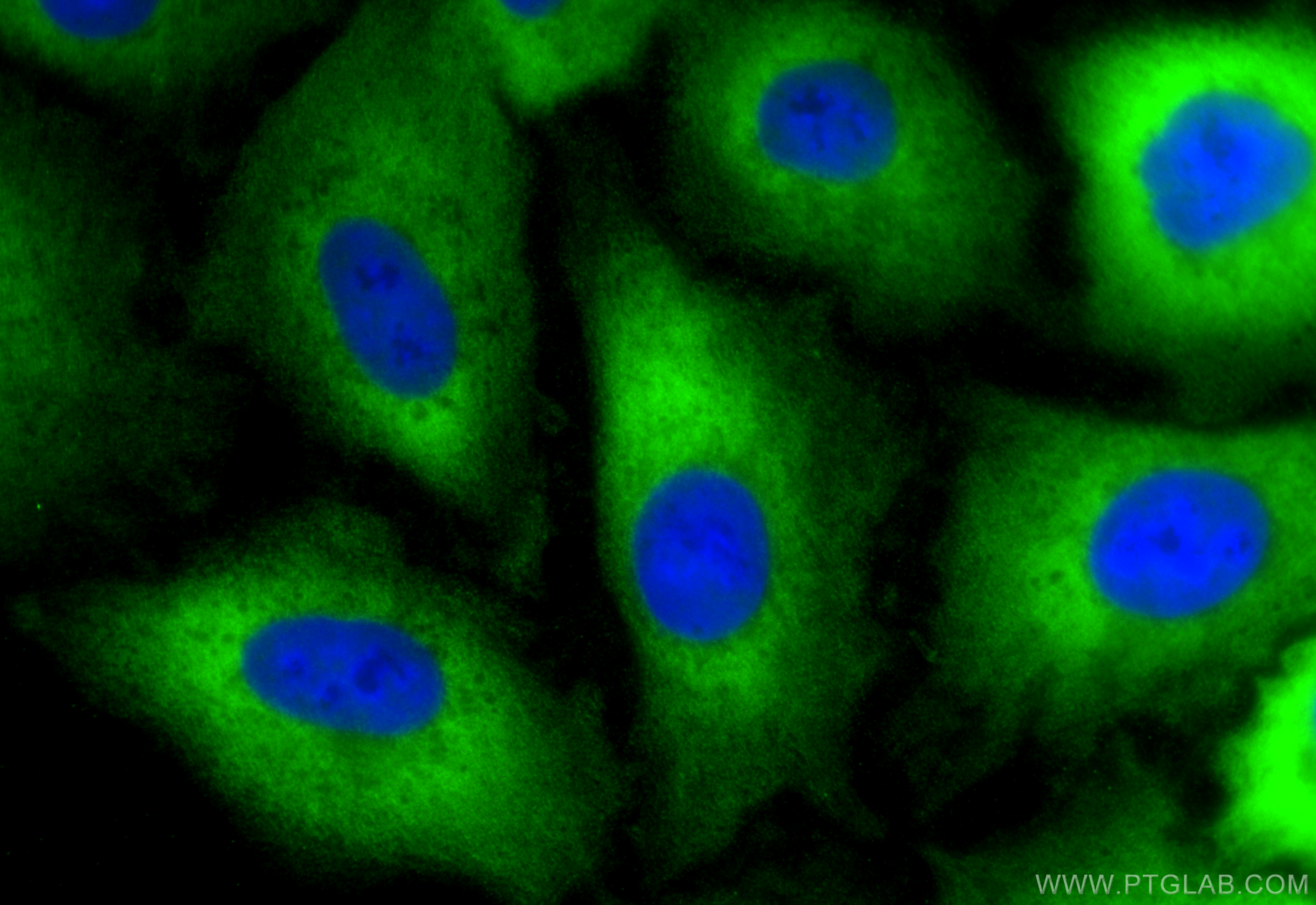 IF Staining of A549 using 66230-1-Ig
