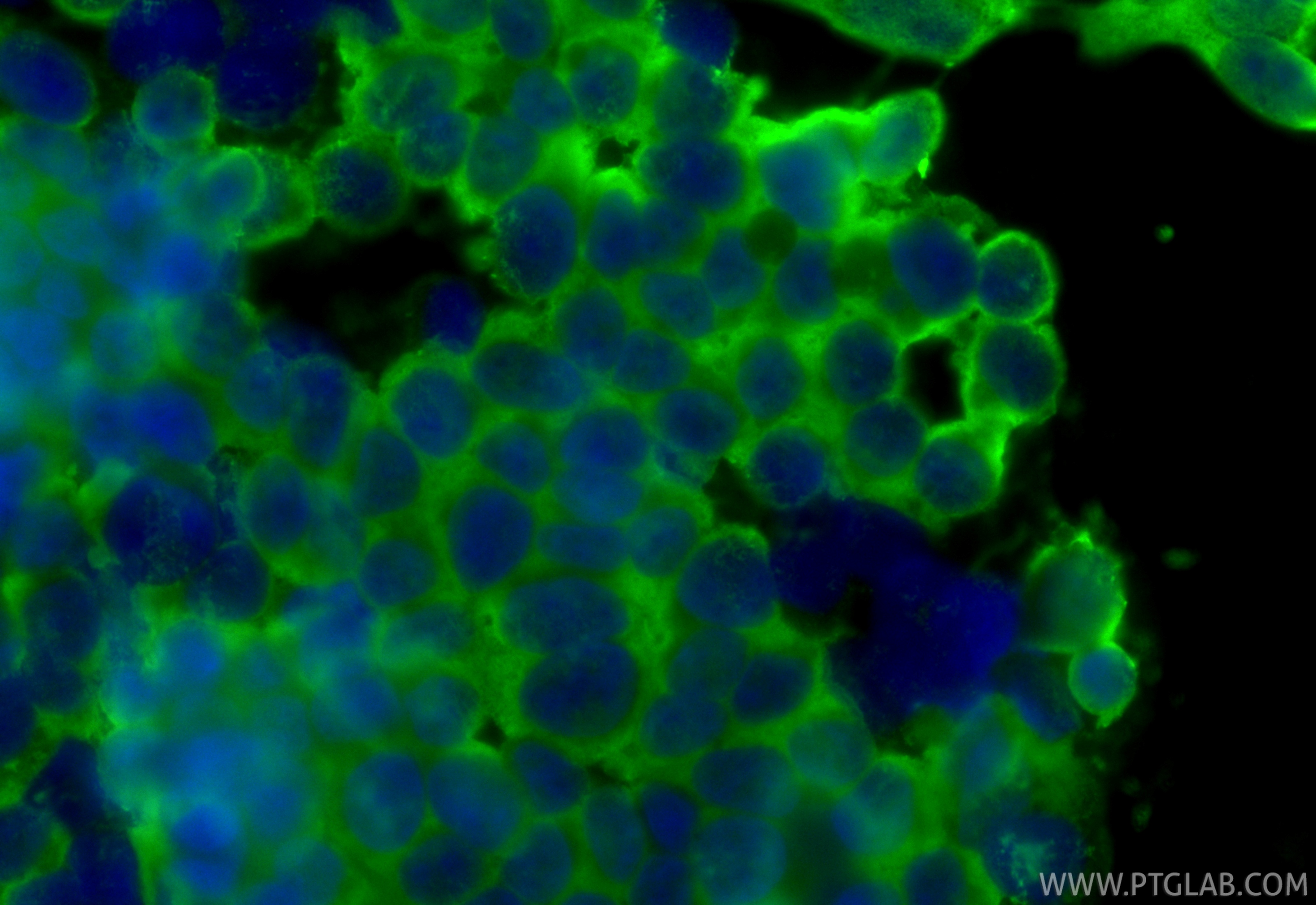 IF Staining of SH-SY5Y using 66230-1-Ig