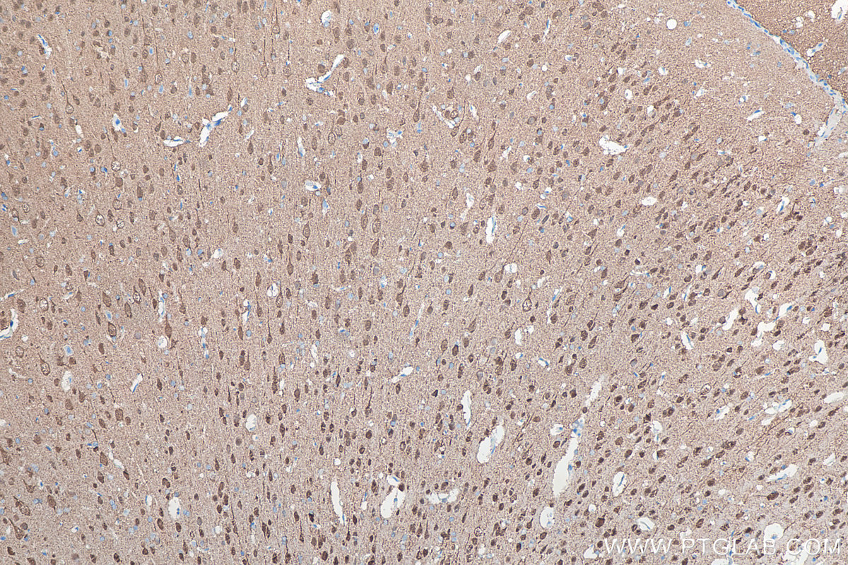 IHC staining of rat brain using 66230-1-Ig IHC staining of rat brain using 66230-1-Ig