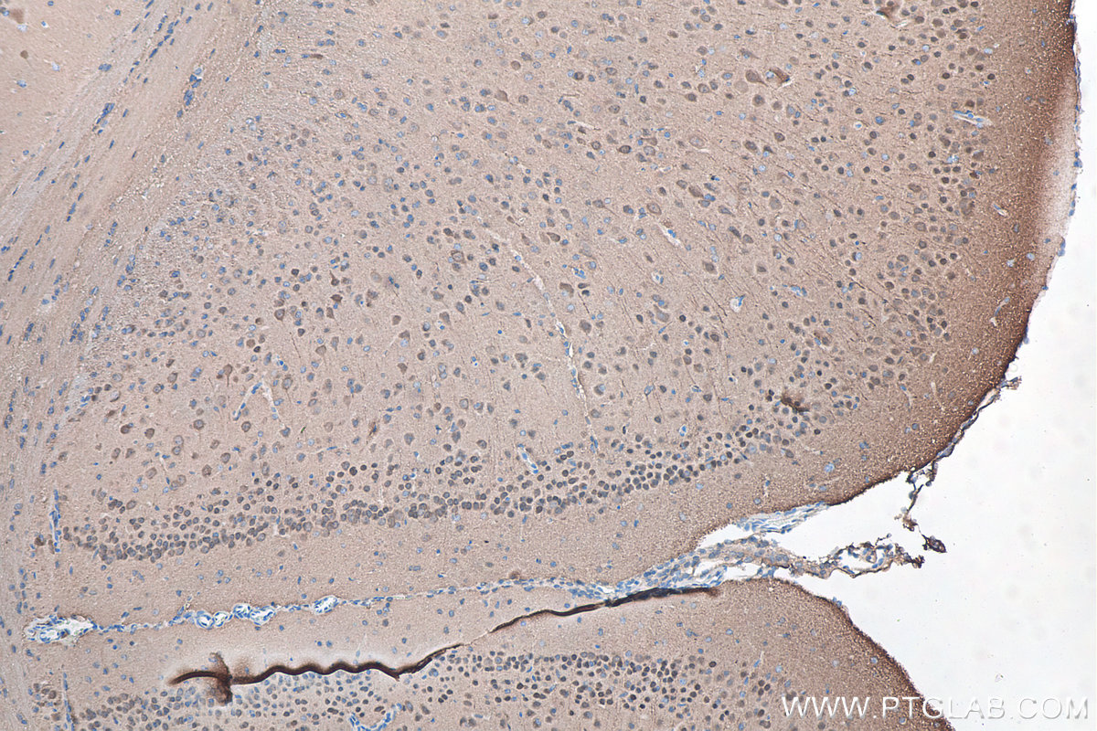 IHC staining of mouse brain using 66230-1-Ig IHC staining of mouse brain using 66230-1-Ig