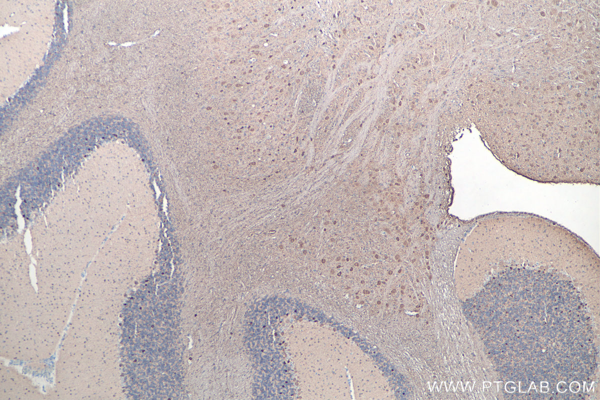 IHC staining of rat cerebellum using 66230-1-Ig IHC staining of rat cerebellum using 66230-1-Ig