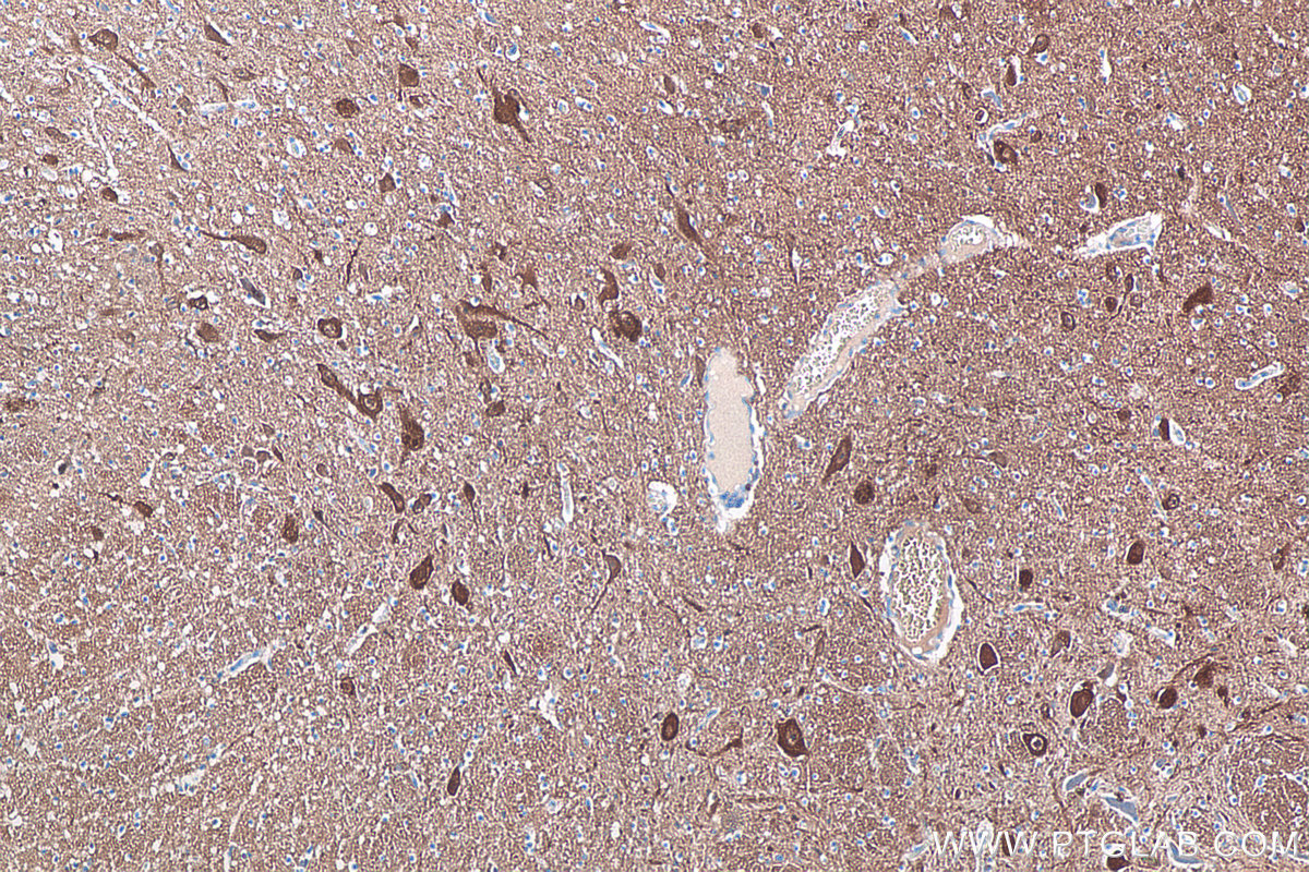 IHC staining of human hypothalamus using 66230-1-Ig IHC staining of human hypothalamus using 66230-1-Ig