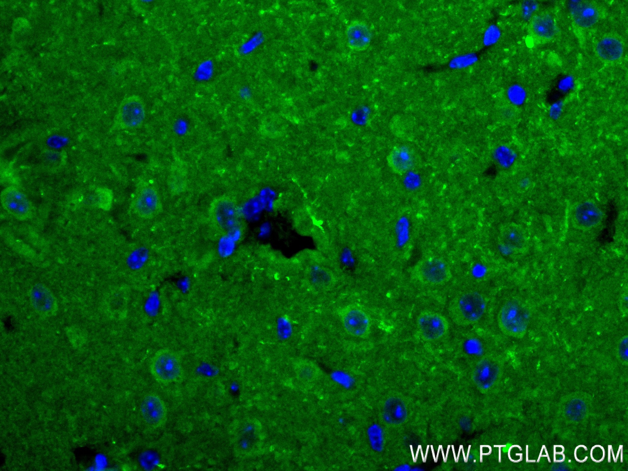 IF Staining of mouse brain using 84154-5-RR