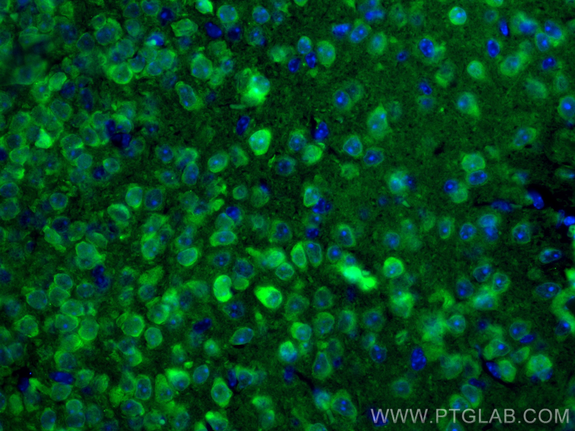 IF Staining of mouse brain using CL488-66230