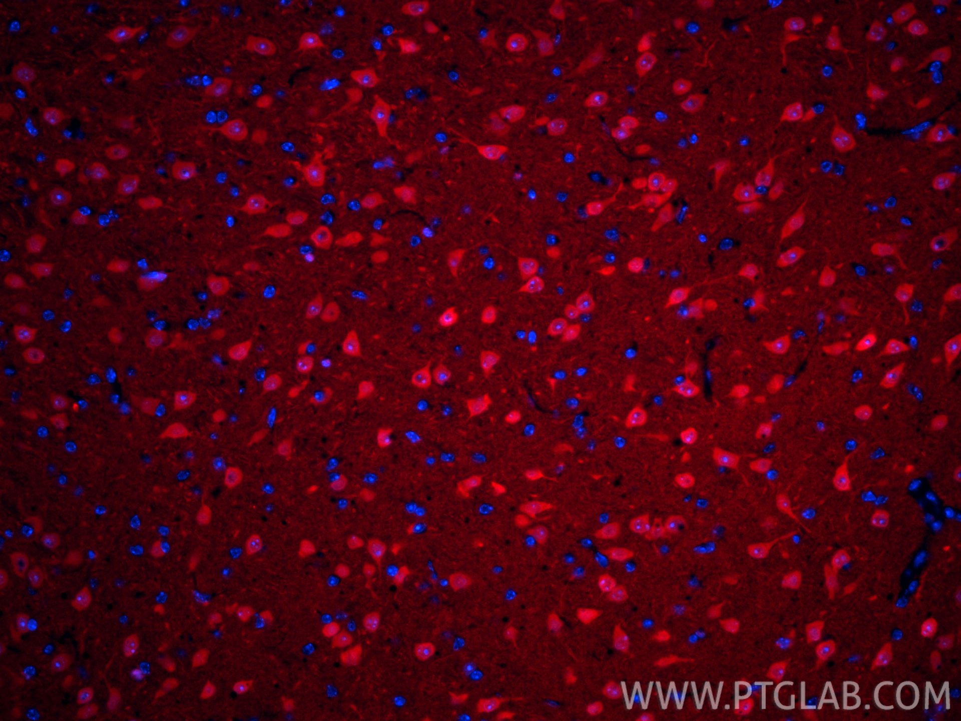 IF Staining of mouse brain using CL594-66230 IF Staining of mouse brain using CL594-66230