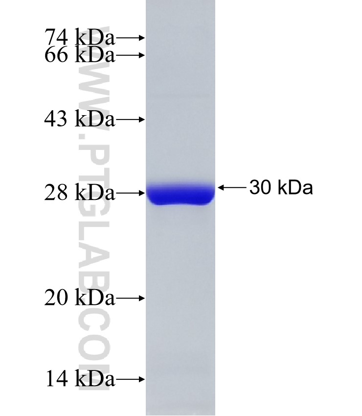 UCHL3 fusion protein Ag32925 SDS-PAGE UCHL3 fusion protein Ag32925 SDS-PAGE