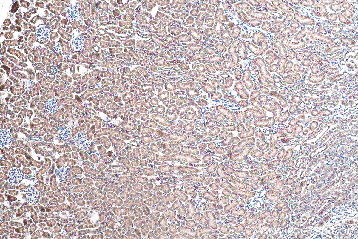 IHC staining of mouse kidney using 11527-1-AP (same clone as 11527-1-PBS)