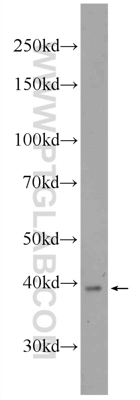 WB analysis of mouse colon using 11527-1-AP