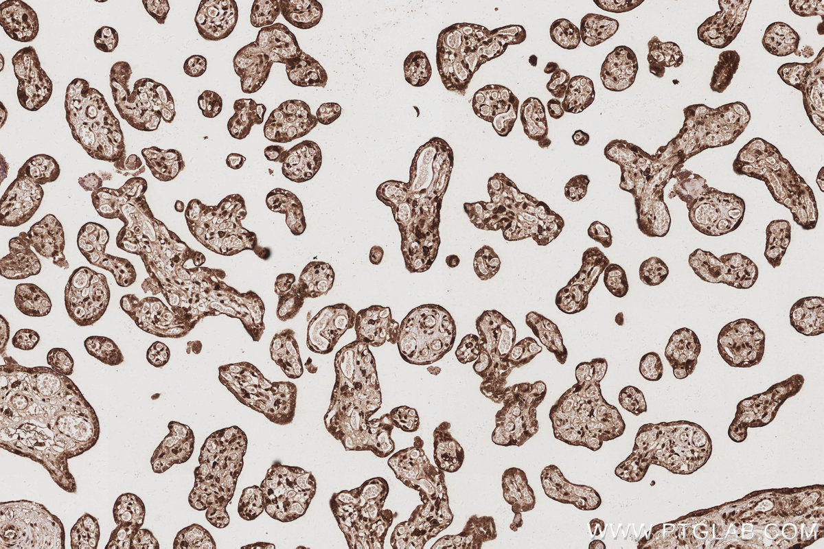 IHC staining of human placenta using 68535-1-Ig IHC staining of human placenta using 68535-1-Ig
