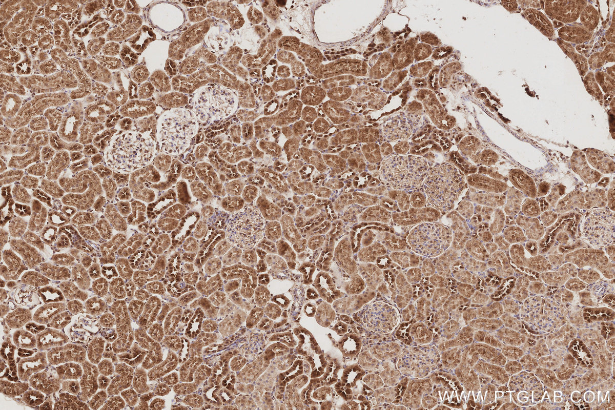 IHC staining of rat kidney using 68535-1-Ig IHC staining of rat kidney using 68535-1-Ig