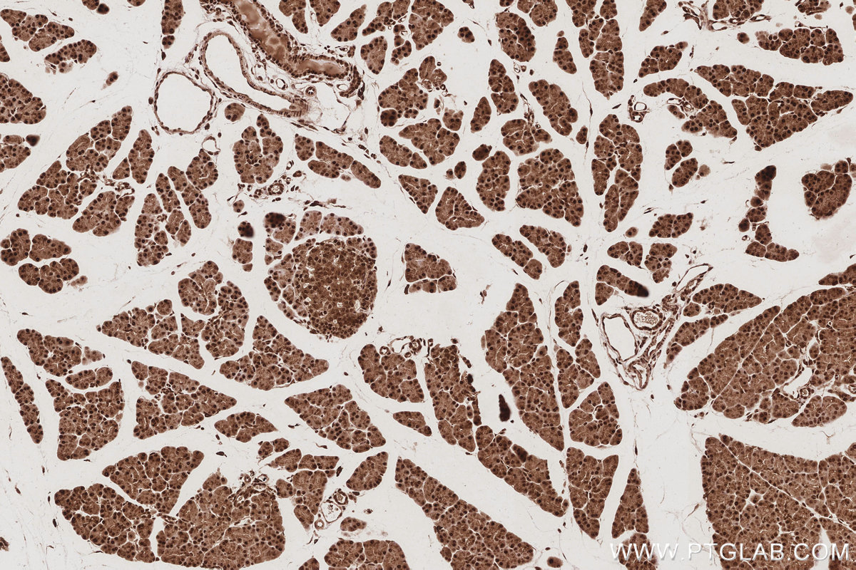 IHC staining of rat pancreas using 68535-1-Ig IHC staining of rat pancreas using 68535-1-Ig