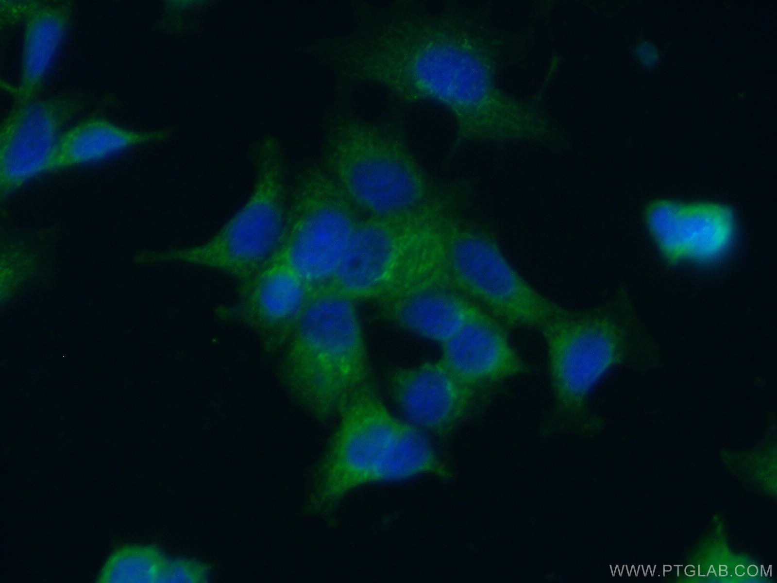 IF Staining of MCF-7 using 17830-1-AP (same clone as 17830-1-PBS)