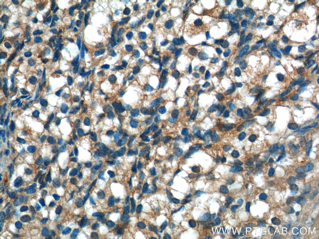 IHC staining of human ovary using 17830-1-AP (same clone as 17830-1-PBS)