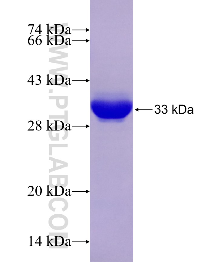 UCK2 fusion protein Ag0782 SDS-PAGE