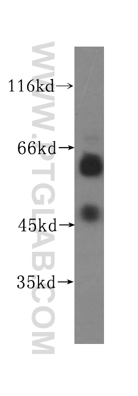 WB analysis of K-562 using 17005-1-AP