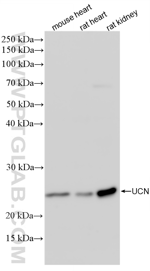 WB analysis using 84380-1-RR WB analysis using 84380-1-RR