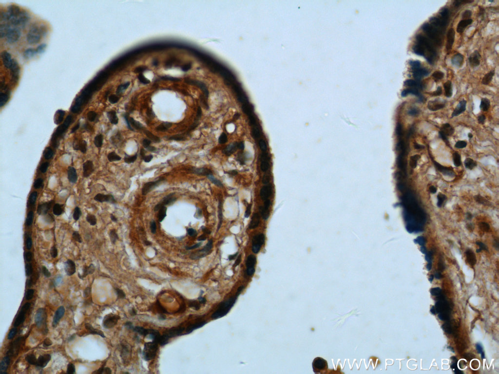 IHC staining of human placenta using 12198-1-AP (same clone as 12198-1-PBS)