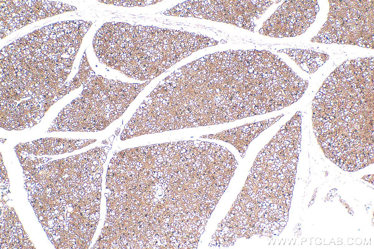 IHC staining of mouse brown adipose using 32710-1-AP