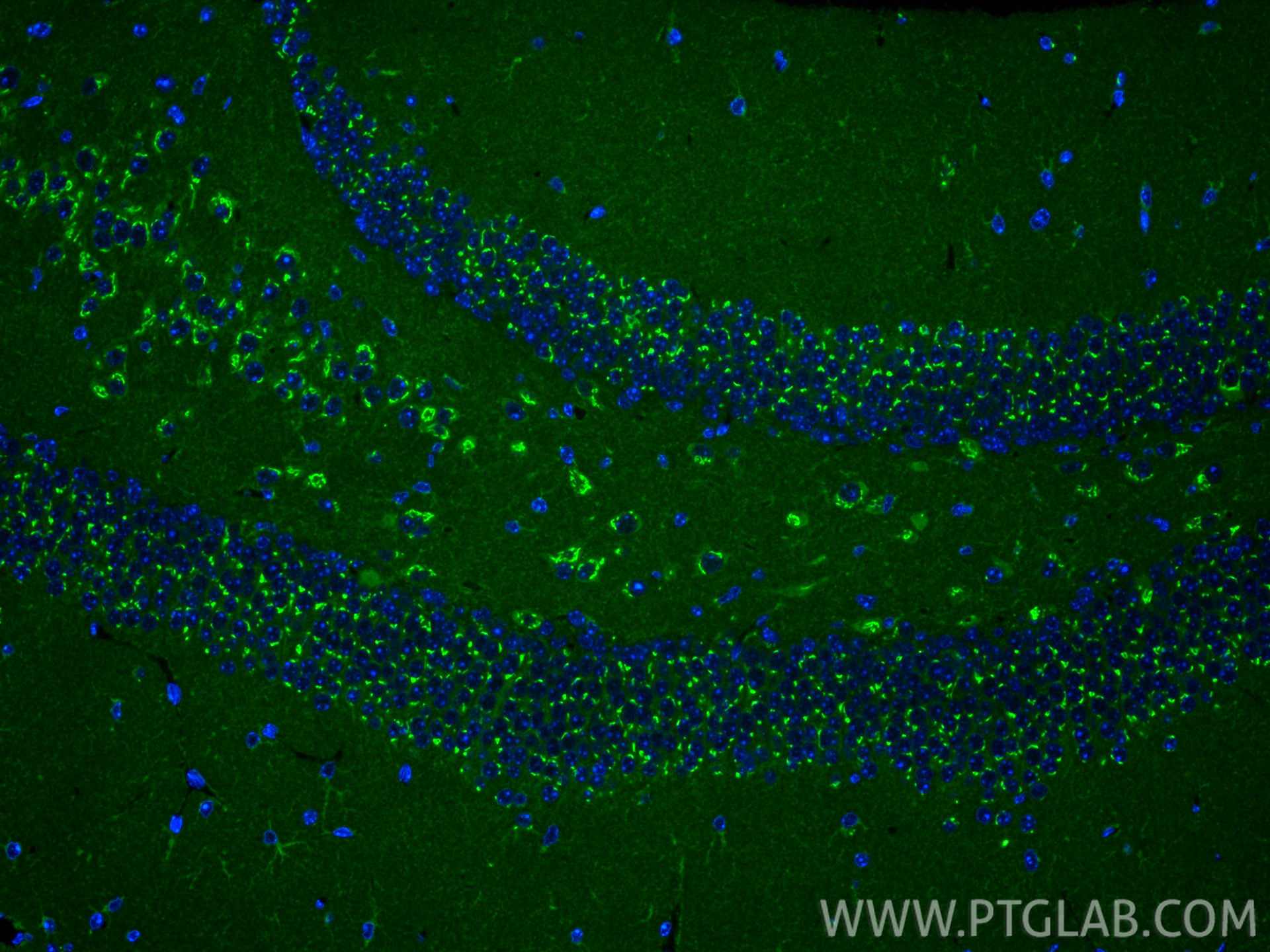 IF Staining of mouse brain using RMX00036