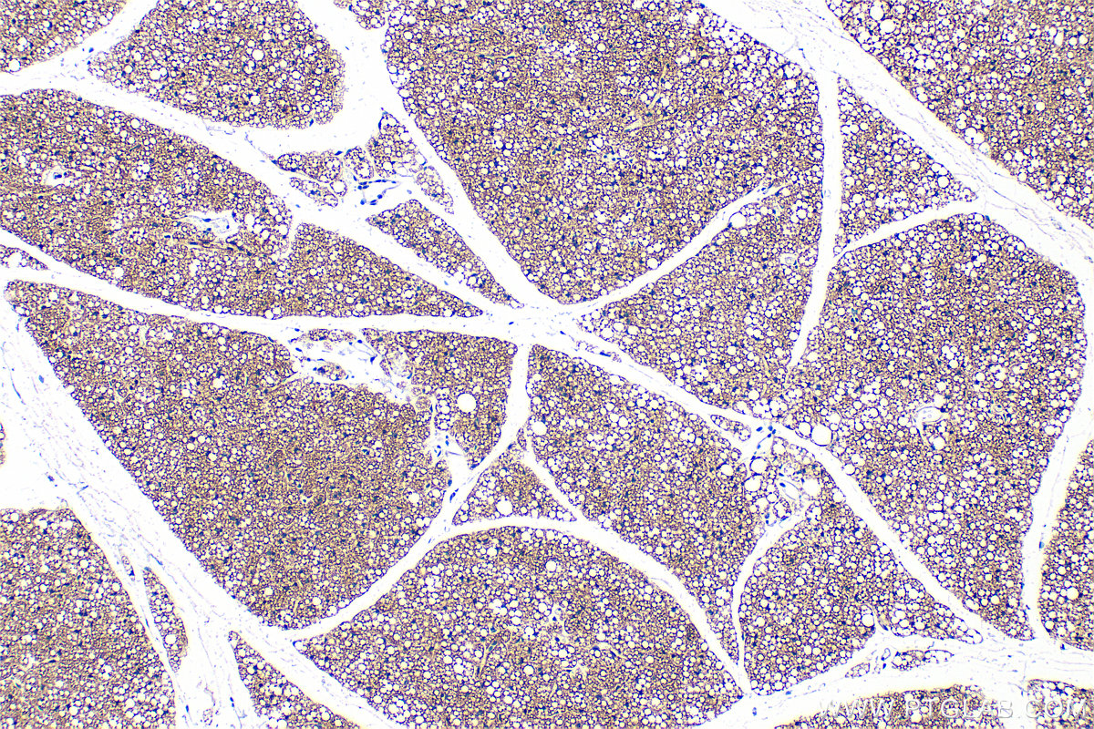 IHC staining of mouse brown adipose using RMX00036 IHC staining of mouse brown adipose using RMX00036