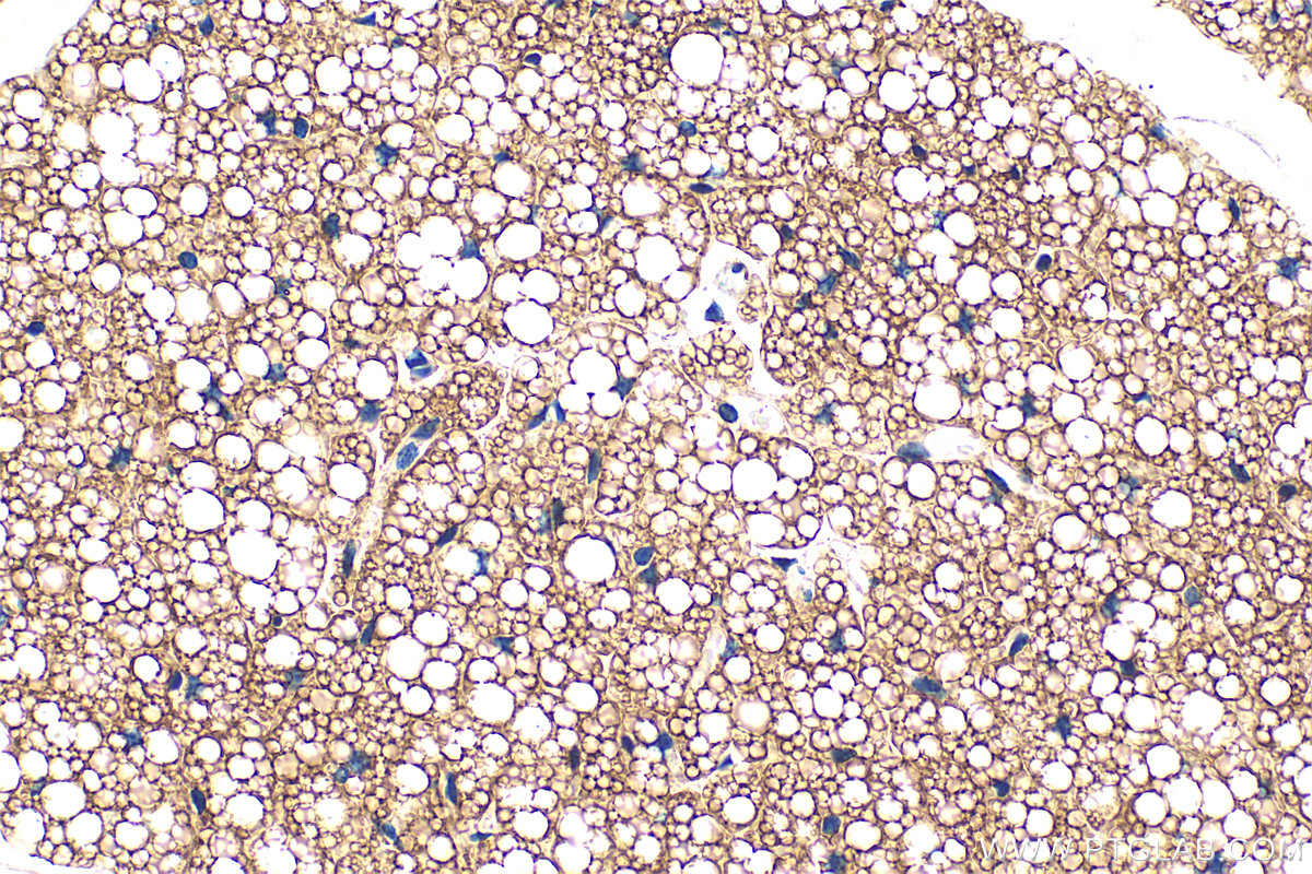 IHC staining of mouse brown adipose using RMX00036 IHC staining of mouse brown adipose using RMX00036